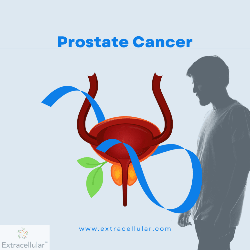 Prostate cancer