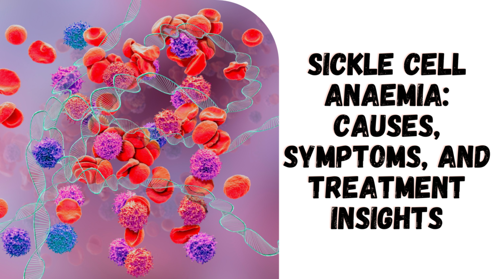 Sickle Cell Anaemia