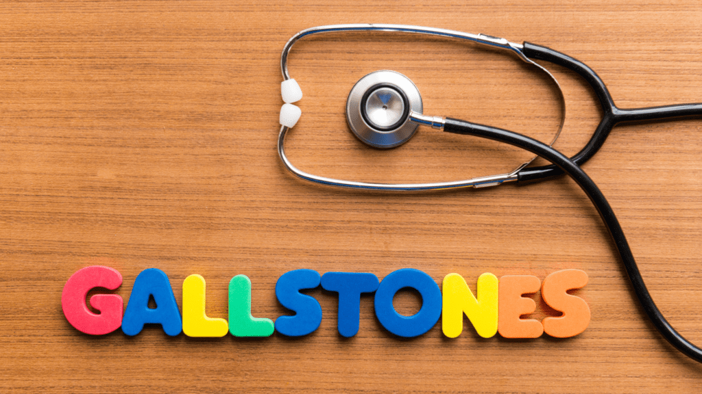 Gallstones